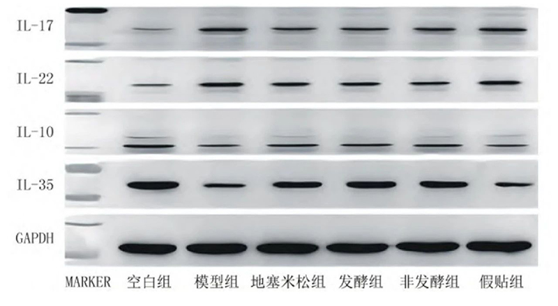 空白組和支氣管哮喘各組大鼠肺組織中IL－17、IL－22、IL－10、IL－35蛋白表達電泳圖